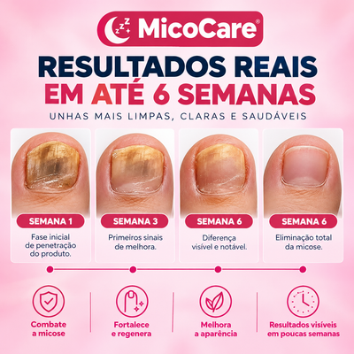 MicoCare - Adesivo para Unhas com Micose