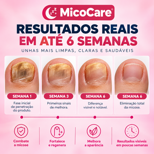 MicoCare - Adesivo para Unhas com Micose