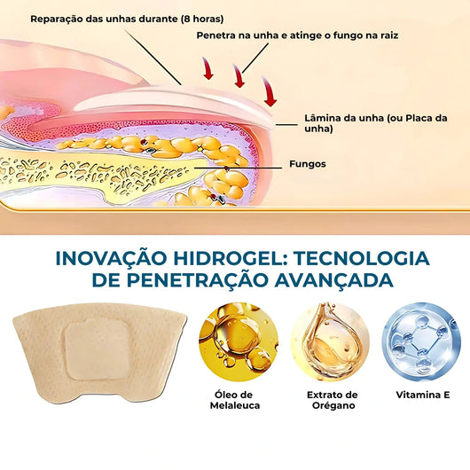 MicoCare - Adesivo para Unhas com Micose